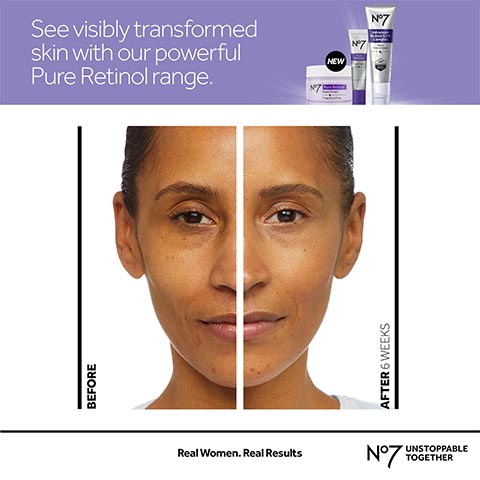 Tretinoin cream, under-eye treatment.