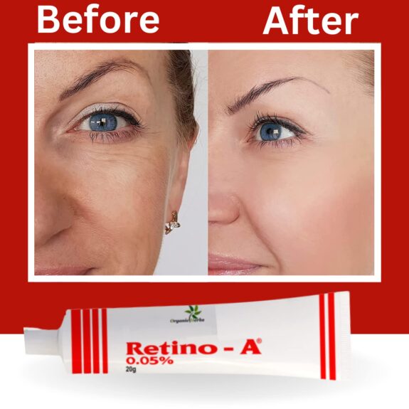 Retino A Tretinoin Cream 0.05%
