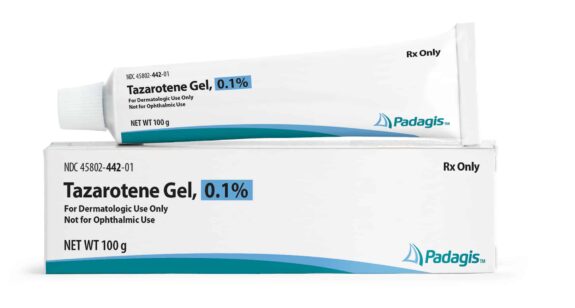 Tazarotene gel topical acne treatment.