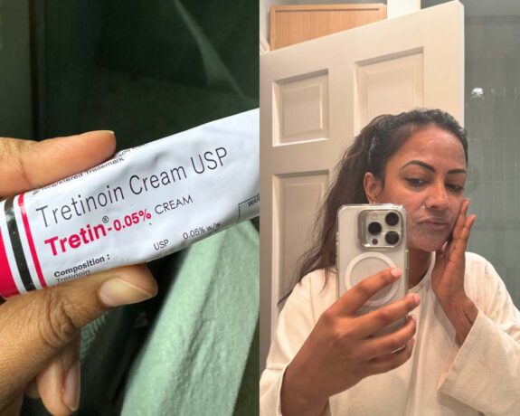 Tretinoin Cream 0.05% before & after results.