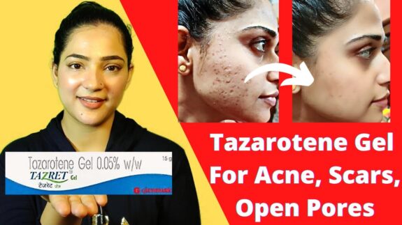 Tazret Gel: Open pore treatment.