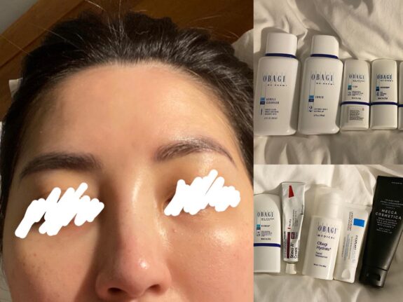 Obagi Tretinoin cream tube.