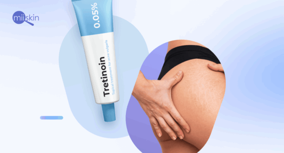 Tretinoin Cream 0.05% for stretch marks.