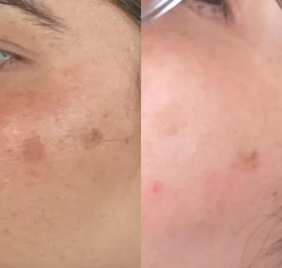 Tri Luma Brightening Serum, Costco price.