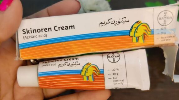 Skinoren Cream before & after: improved skin clarity.