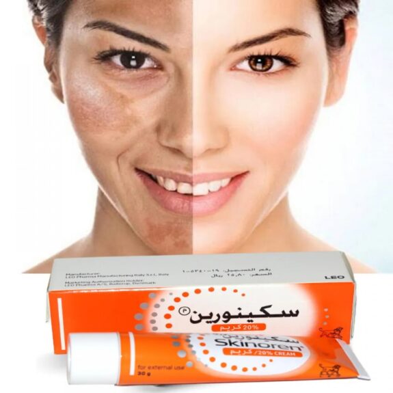 Skinoren Pigmentation cream tube.