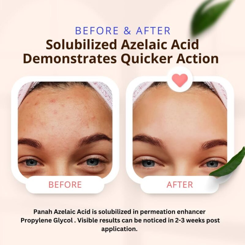 Azelaic acid & niacinamide serum bottle.